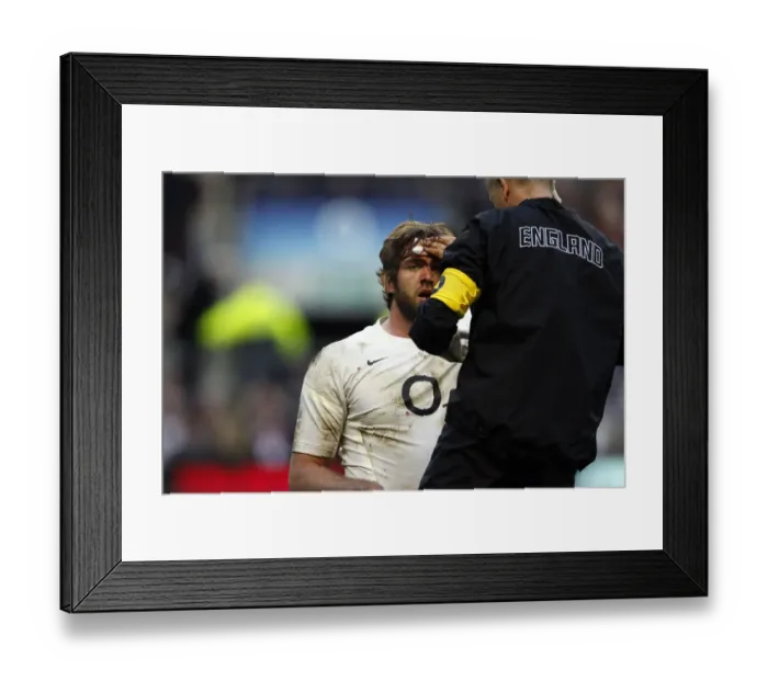 Framed Print : Geoff Parling Injury Framed Print : Geoff Parling Injury