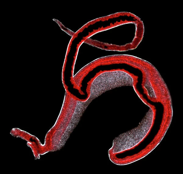 Schistosoma spp. blood flukes