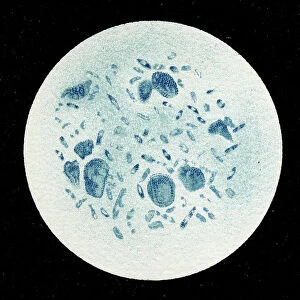 Colony of Yersinia pestis, 1906 (litho)