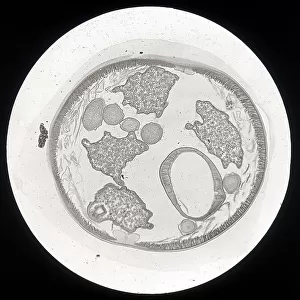 Cross-section of the Ascaris lumbricoides (Nematodea) enlarged under a microscope