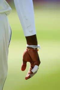 Lanka Prints: Bowlers Bandaged Hand
