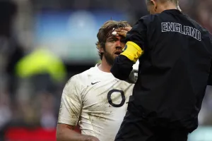 Injury Prints: Geoff Parling Injury